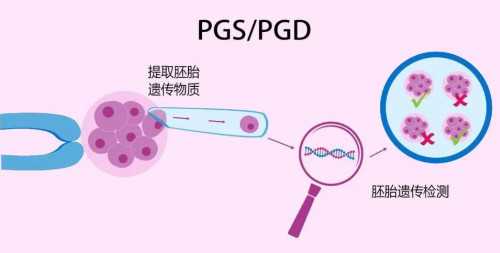 宫外孕hcg会翻倍吗？宫外孕需谨慎~私人代孕服务