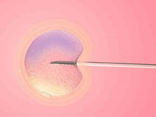 东方自体干细胞移植费用大概多少钱~优生代怀