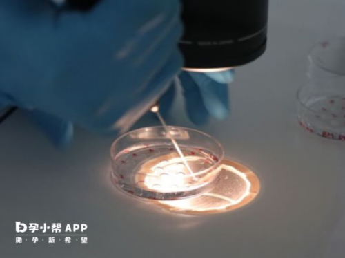 高精子畸形率应该如何治疗？附最佳治疗方法~试管代生