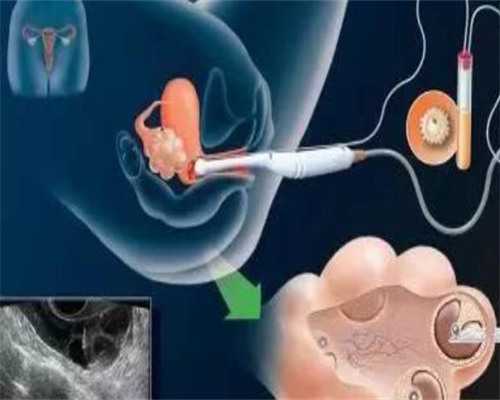 定坤丹有助于着床吗~供卵代怀咨询